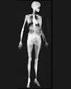 X-ray