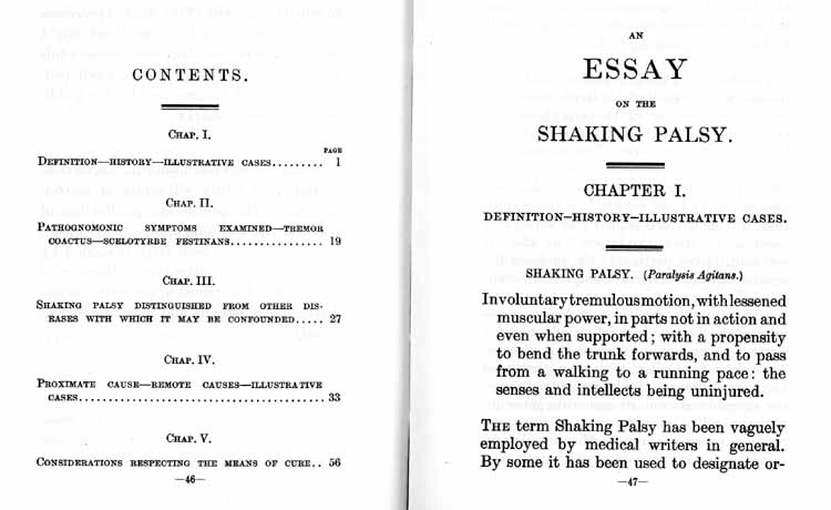 An essay on the shaking palsy by james parkinson 1817